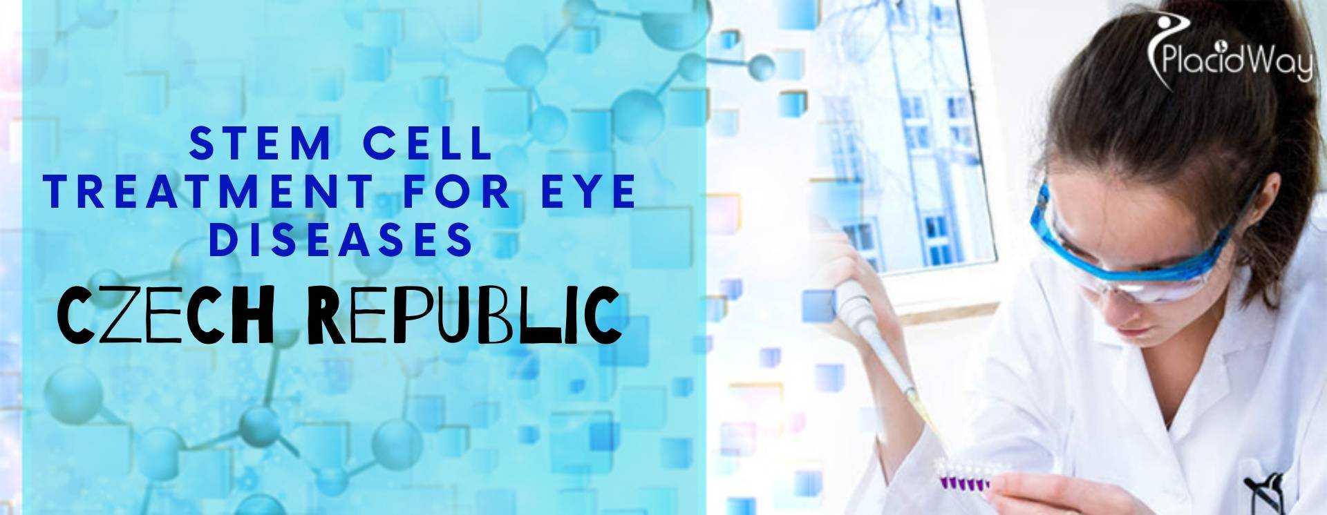 Stem Cell Treatment for Eye Diseases in the Czech Republic